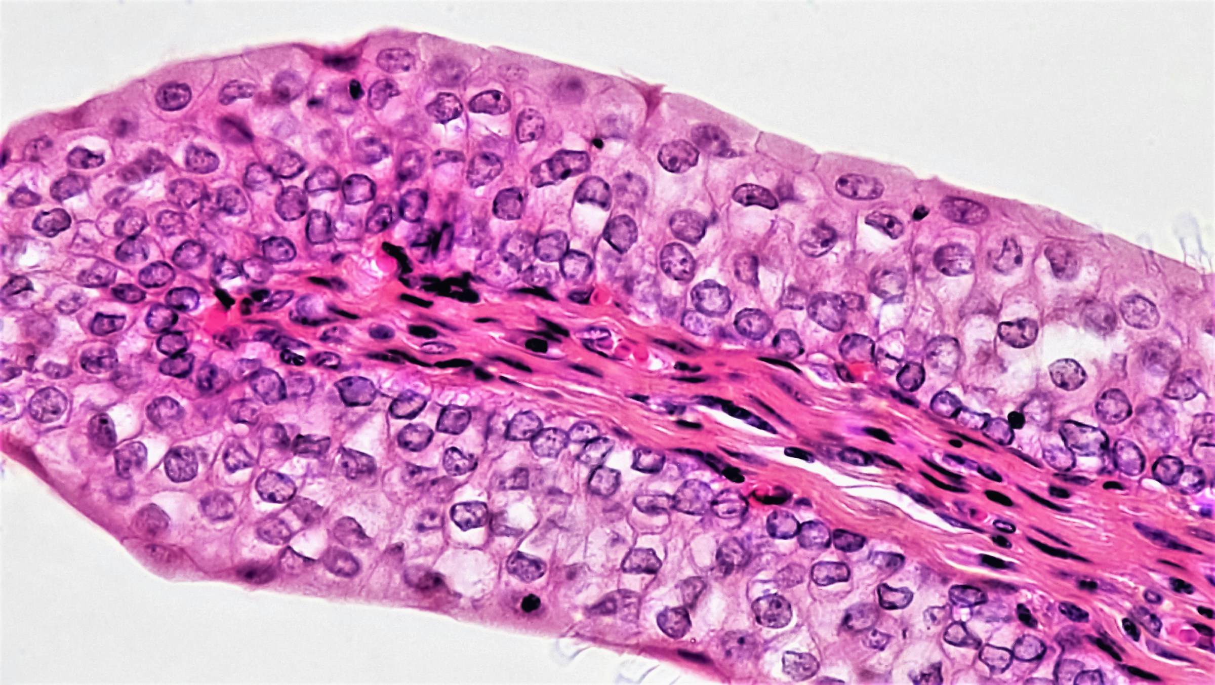 A Beginner’s Guide to Histological Image Analysis with Deep Learning