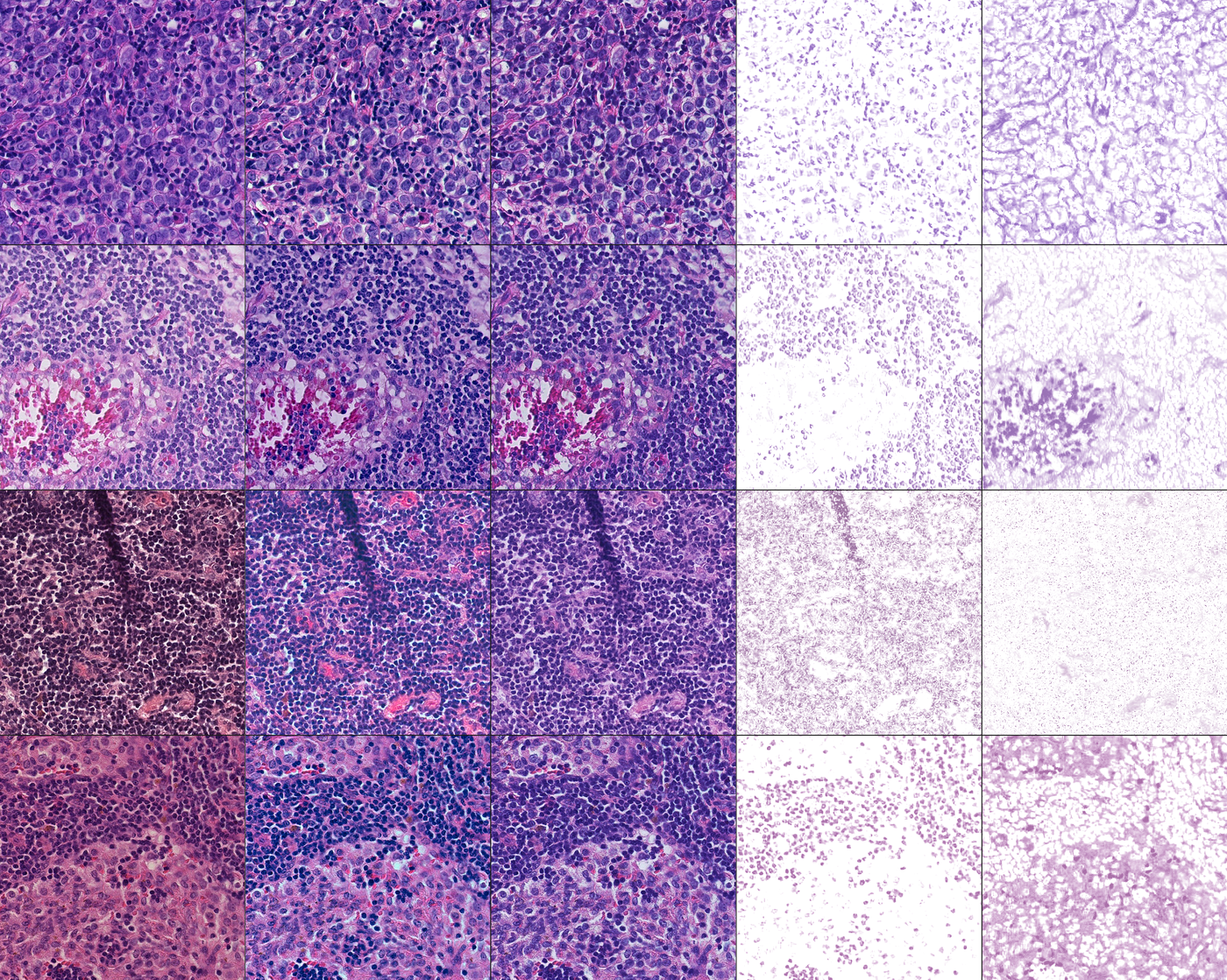 The Mathematics of Stain Normalisation in Digital Pathology: Messy Methods
